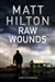 Raw Wounds | Hilton, Matt | Signed First Edition UK Book